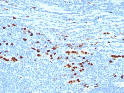 Formalin-fixed, paraffin embedded human tonsil sections stained with 100 ul anti-Calprotectin (clone MAC387) at 1:200. HIER epitope retrieval prior to staining was performed in 10mM Citrate, pH 6.0.